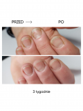 NAILSOFTHEDAY Podology+ ONISTOP - 8ml